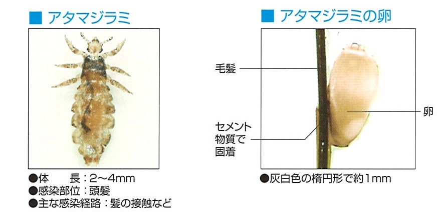 本郷三丁目で頭ジラミの治療ならやおさか皮フ科クリニック